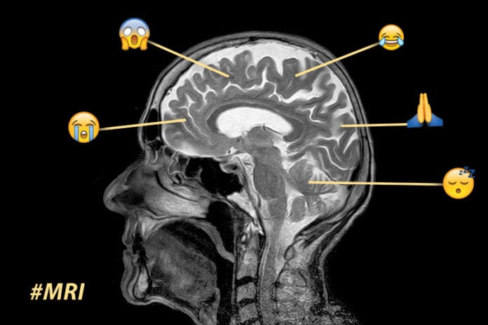 Twitter MRI Image