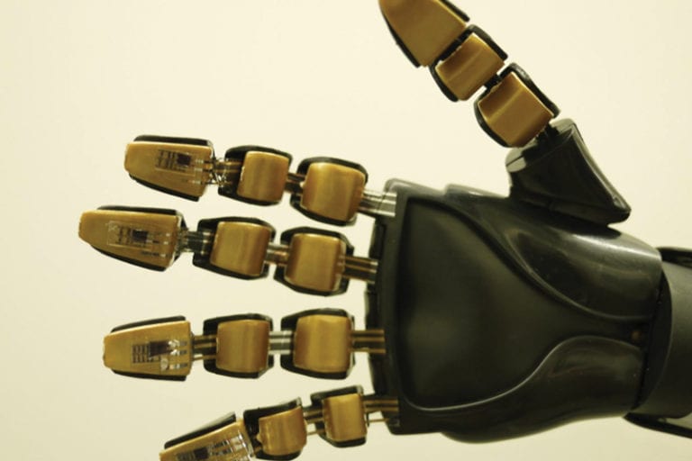 Prosthetic Hand Image